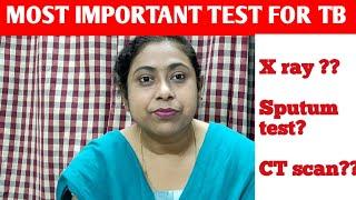 WAT IS THE MOST IMPORTANT AND PRIMARY TEST TO DIAGNOSE PULMONARY TUBERCULOSIS