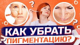 Пигментация - как убрать?