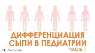 Сыпь в педиатрической практике: как правильно поставить диагноз при экзантемных заболеваниях?