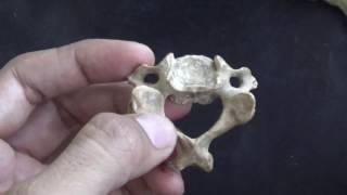 CERVICAL VERTEBRAE -  QUICK IDENTIFICATION POINTS