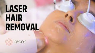 Laser Hair Removal: How it Works, Cost and more at  Recon !