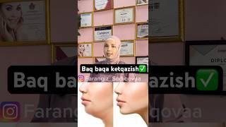 Uy sharoitida #skincare #skincareroutine #uzbekchastrim #beauty #diy #duet baq-baqani ketqazish