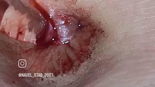 navel stab 