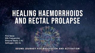 Healing Haemorrhoids & Rectal Prolapse | Binaural Delta Waves | Solfeggio 285 Hz | Rife Frequencies