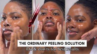 How To Use The Ordinary Peeling Solution Correctly For Smooth Skin | Do’s & Don’ts