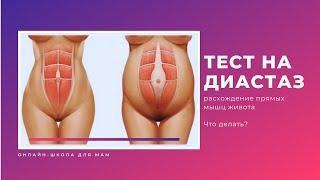 Тест на ДИАСТАЗ (расхождение) прямых мышц живота | КАК ОПРЕДЕЛИТЬ диастаз после родов | Диагностика