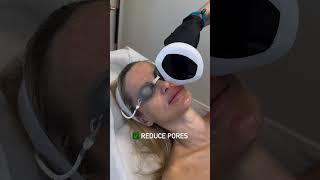 IPL Facial in Newport Beach- Skinsation OC