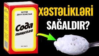 1 Qaşıq SODA görün hansı xəstəlikləri sağaldır - Həkimlər niyə demir?