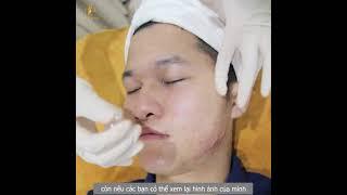 ĐIều trị mụn Doctor Spa 26 2