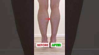 Slimmer LEGS, Reduce Swelling [5 MINS]
