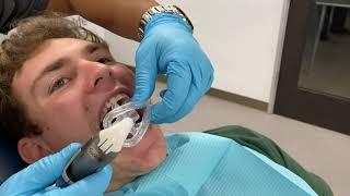 I2 and isodry Isolite Anterior Mouthpiece Adapter – Placement tips and techniques