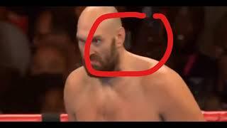 Tyson Fury vs Deontay Wilder HIGHLIGHTS FIXED? MUST WATCH!