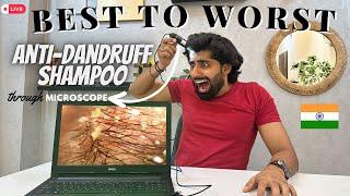 Your Favourite Anti-Dandruff Shampoo FAILED | Best To Worst Shampoo In India | Mridul Madhok