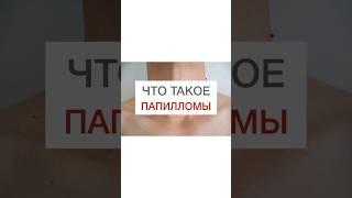 ЧТО ТАКОЕ ПАПИЛЛОМЫ? #shorts #здоровье #нутрициолог #папилломы