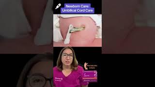 Umbilical Cord Care: Maternity Nursing SHORT | @LevelUpRN