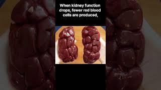 Common symptoms of Kidney Disease #kidney #kidneydisease #kidneyfailure