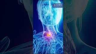 Throat Lumps: When to Worry & How SIMS Hospital Can Help