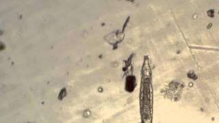 Unknown creature in water drop under the microscope