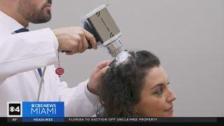 Hair loss treatment breakthrough brings results to those in South Florida