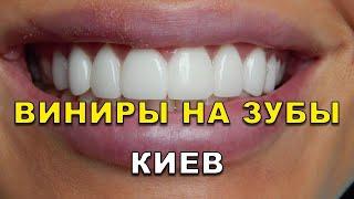 Виниры в Киеве. Видео - Виниры для зубов в клиниках ЛюмиДент (вініри)