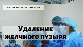 Хронический калькулезный холецистит. Операция по удалению желчного пузыря в Consilium Medical