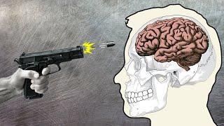 Anatomy of a Headshot