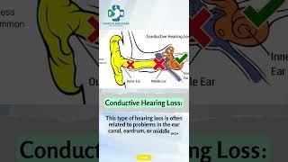 Unveiling Hearing Health: Your Guide to Understanding Types of Hearing Loss! #ent