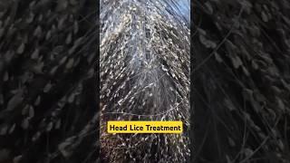 Get rid of Head LICE and EGGS! #headliceremoval #headlice #shorts #dadumedicalcentre