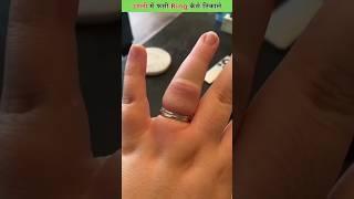 Remove Stuck RING  #facts #shorts #ytshorts