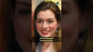 Anne Hathaway Transformation ⭐ Then And Now #shorts #annehathaway