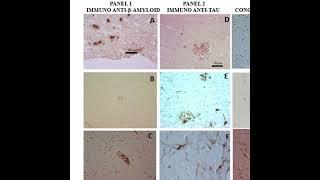 How did I discover Alzheimer’s Disease in dolphins?A long history 2002-2017