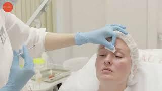 Инъекции Ботокс (Botox), Коррекция ботулотоксинами