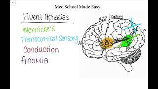 Fluent Aphasias Made Easy: How to Distinguish and Remember Them!