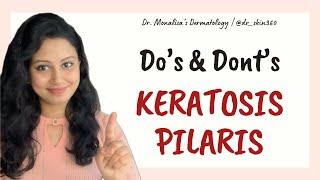 KERATOSIS PILARIS- Do’s and Dont’s