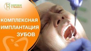 Восстановление зубного ряда.  Комплексная имплантация поможет быстро восстановить зубной ряд.