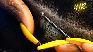 {ASMR} 1 HR Super Attentive NITPICKING SCALP WHITEHEADS | zoomed