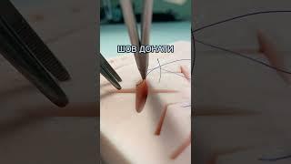 ХИРУРГИЧЕСКИЙ ШОВ ДОНАТИ | SCALPEL.MED #shorts