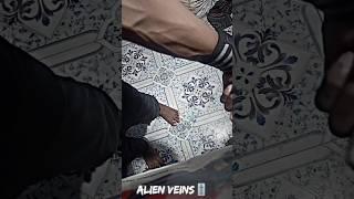 Alien Veins ️ of a 16 year boy  @Rehanaethetic @obaidpathankhan @aadarshdandriyal #shorts#YT