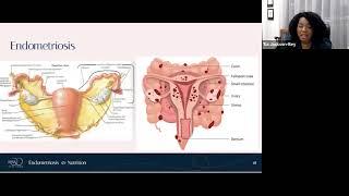 Nourish to Flourish! Reducing Inflammation Through Nutrition