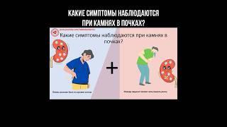 Какие симптомы наблюдаются при камнях в почках? #почки #камнивпочках #нефрология #почка