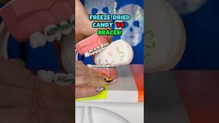 Is FREEZE DRIED CANDY safer for BRACES? Orthodontist Tries and REACTS #braces #candy #shorts