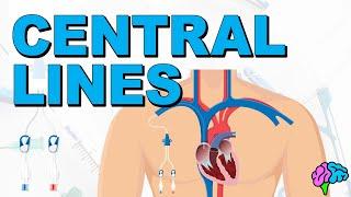 The Basics of Central Lines - Central Venous Catheters (CVC)