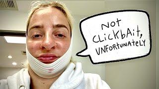 My botched plastic surgery story + why I tattooed my neck