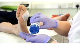Hot Spot blister prevention
