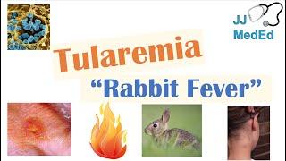 Tularemia (Rabbit Fever) | Causes, Pathogenesis, Forms, Symptoms, Diagnosis, Treatment