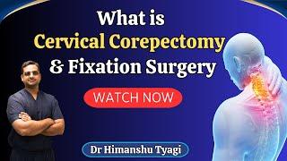 What is cervical Corepectomy & Fixation surgery | Dr Himanshu Tyagi