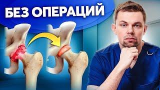 Пошаговый план лечения суставов! Лучшие способы БЕЗ ОПЕРАЦИИ