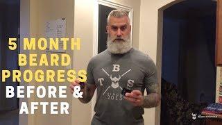 Beard Struggle Before & After - 5 Months