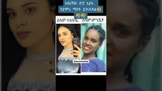 አርቲስቶች be for and after abel birhanu  ethiopian news #zehabesha  #Donkey youtube ድንቅ ልጆች