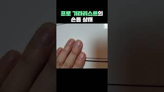 프로 기타리스트의 손톱 상태